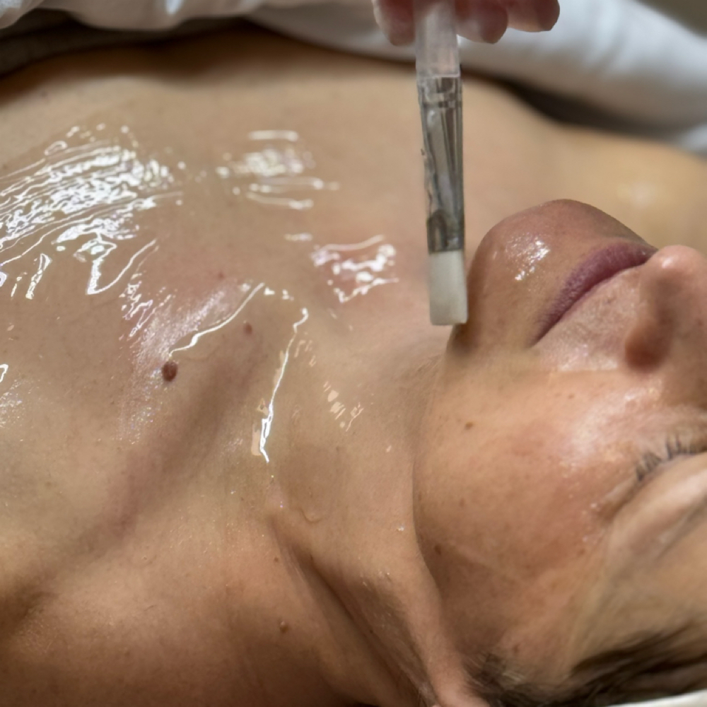 Peels Servise at Beauty Zone by Tetiana Cherepaka in Chicago, IL