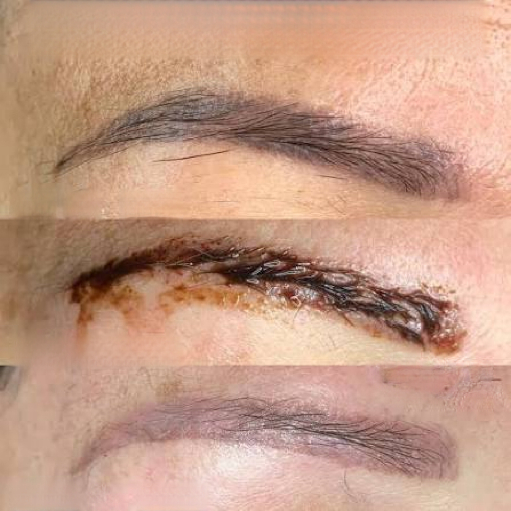 REMOVAL-BROWS at BEAUYBYJOJO PMU STUDIO in Plainfield, IL