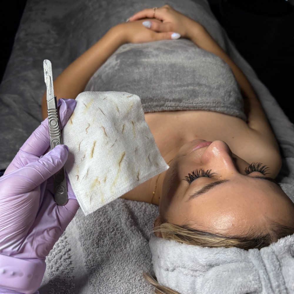 Dermaplaning Facial