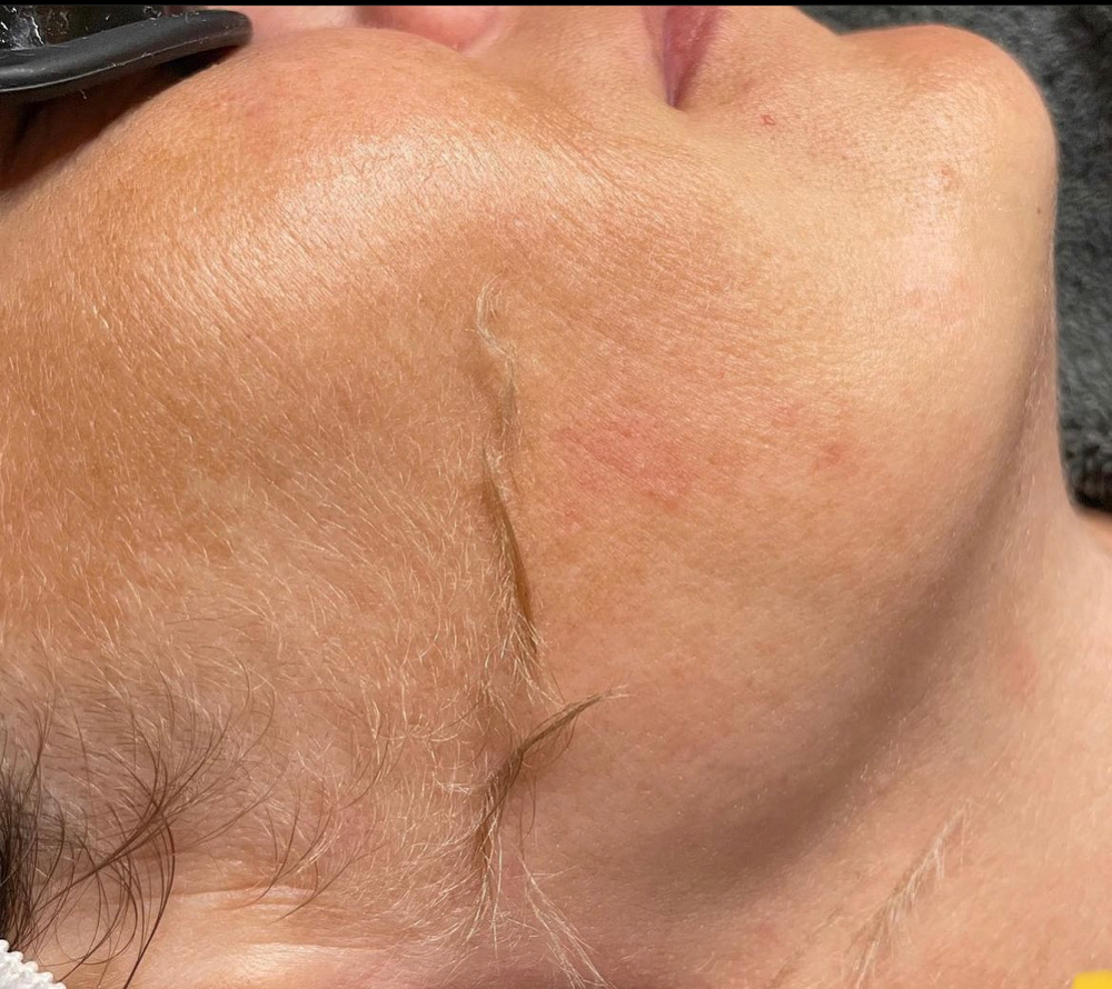 Dermaplane Add On at Madeupbymirandaa in Los Angeles, CA