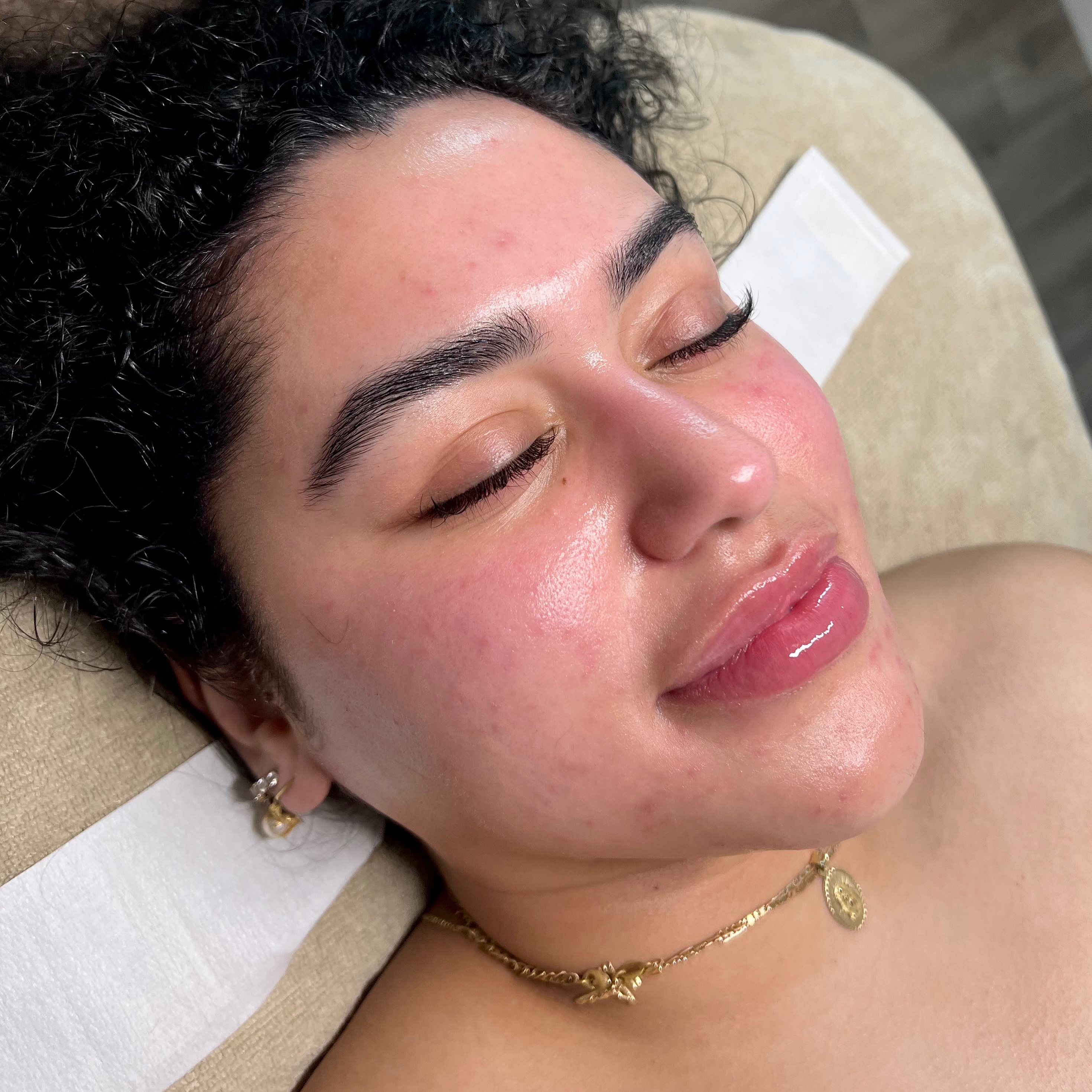 Face Reality Acne Boot Camp at Martini Esthetics in Concord, CA