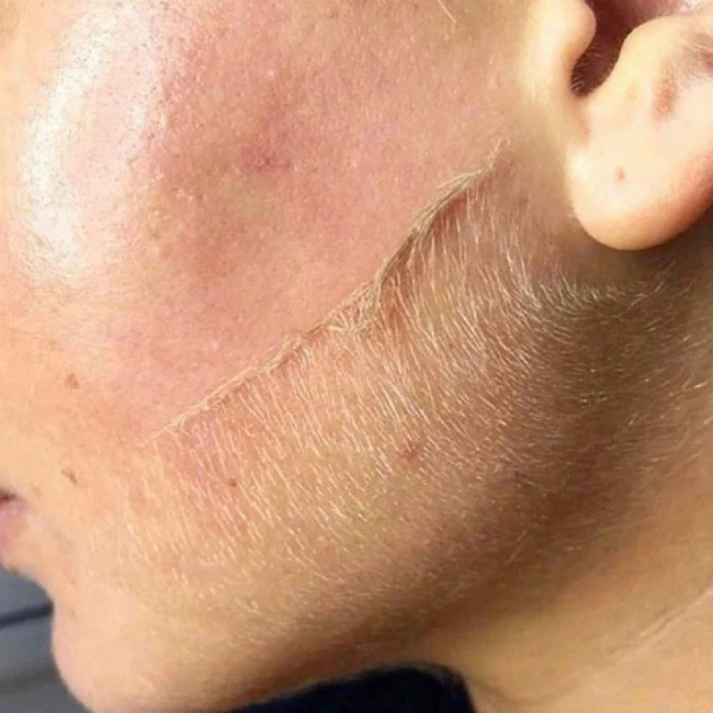 Dermaplaning at Alchemy Head Spa & Salon in Mount Dora, FL