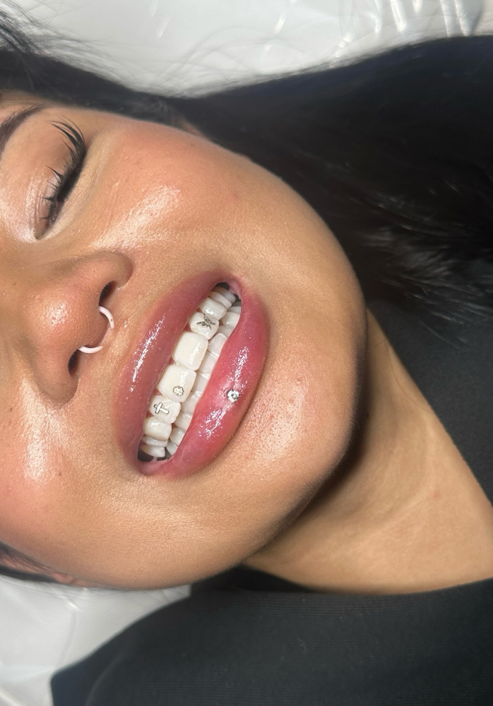 60 Min Teeth Whitening