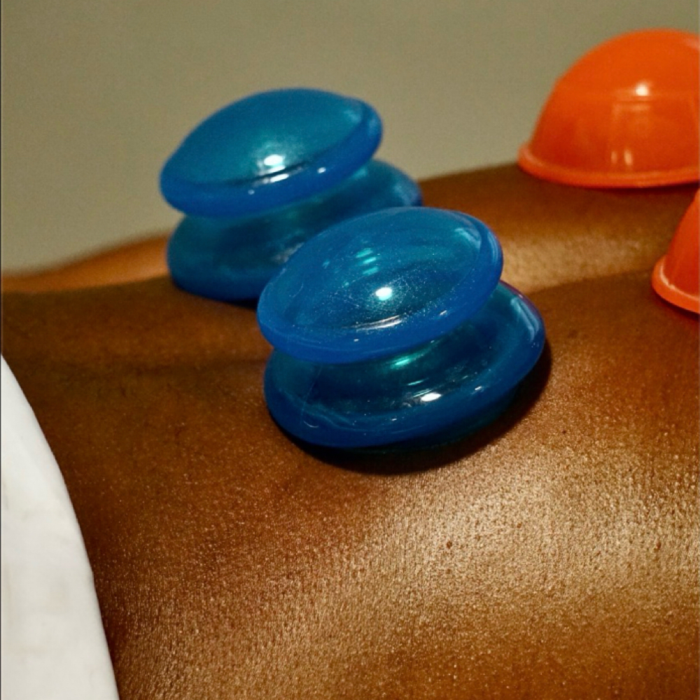 30-Minute Cupping at Divine Timing Massage Therapy & Natural Healing, LLC in Downers Grove, IL