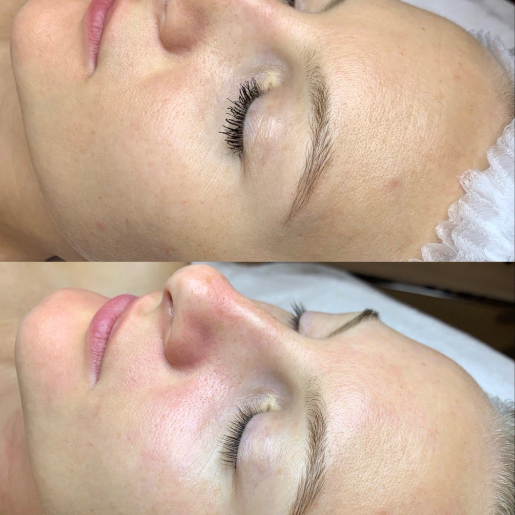 Deep Cleansing Facial at Healthy skin by Alvina in Highland Park, IL