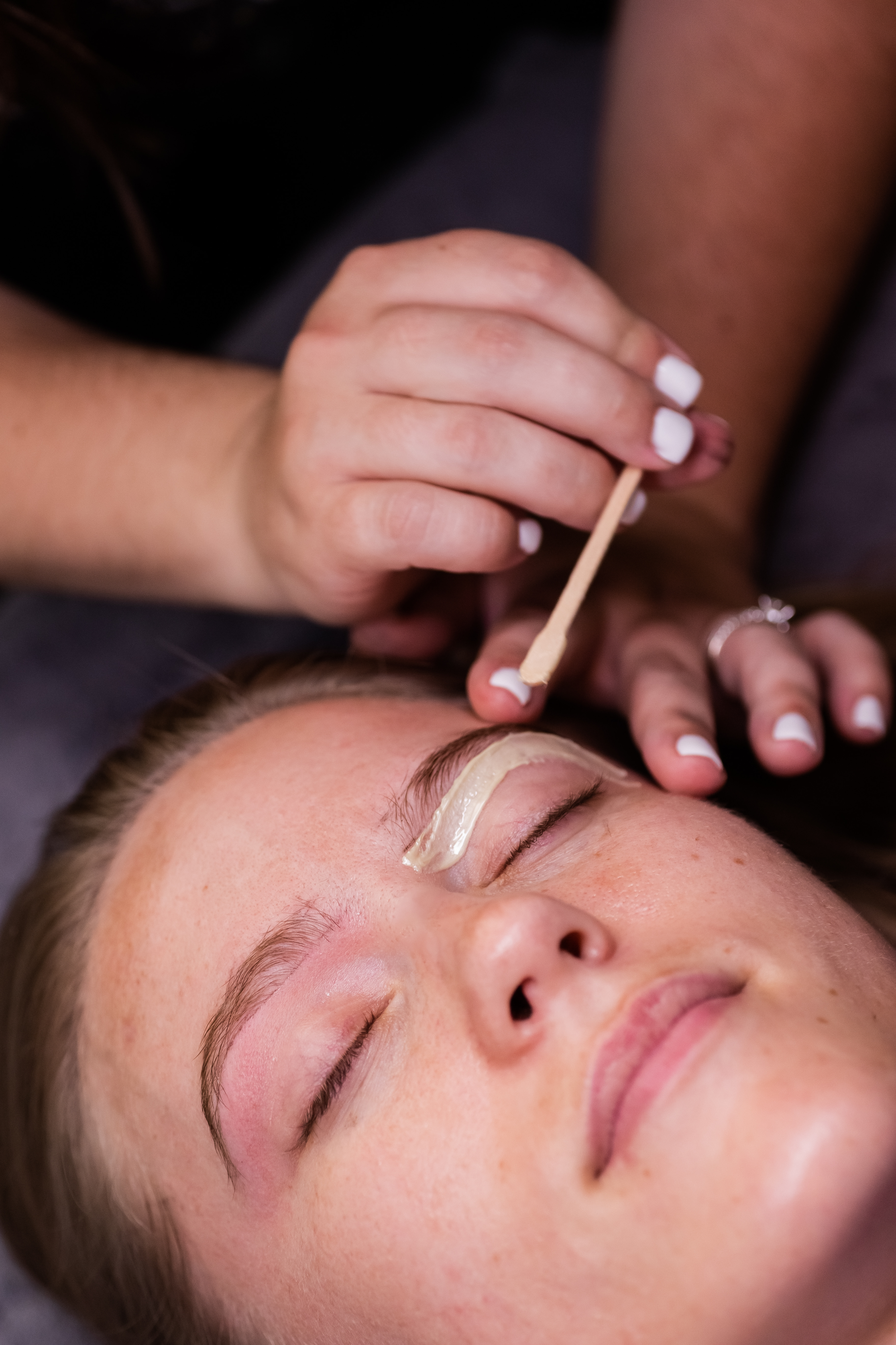 Brow Rehab