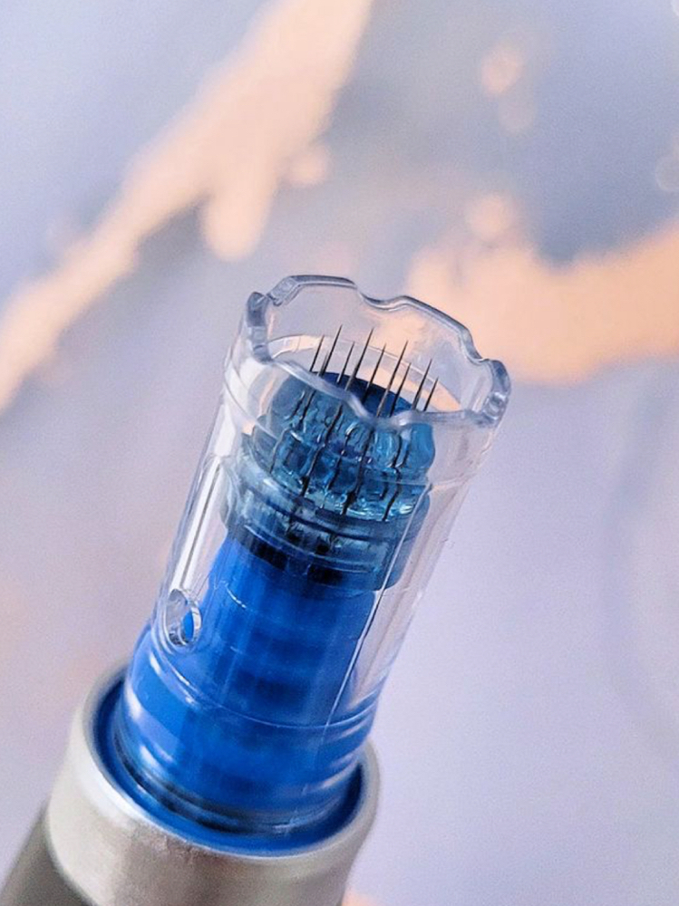 Microneedling Treatment