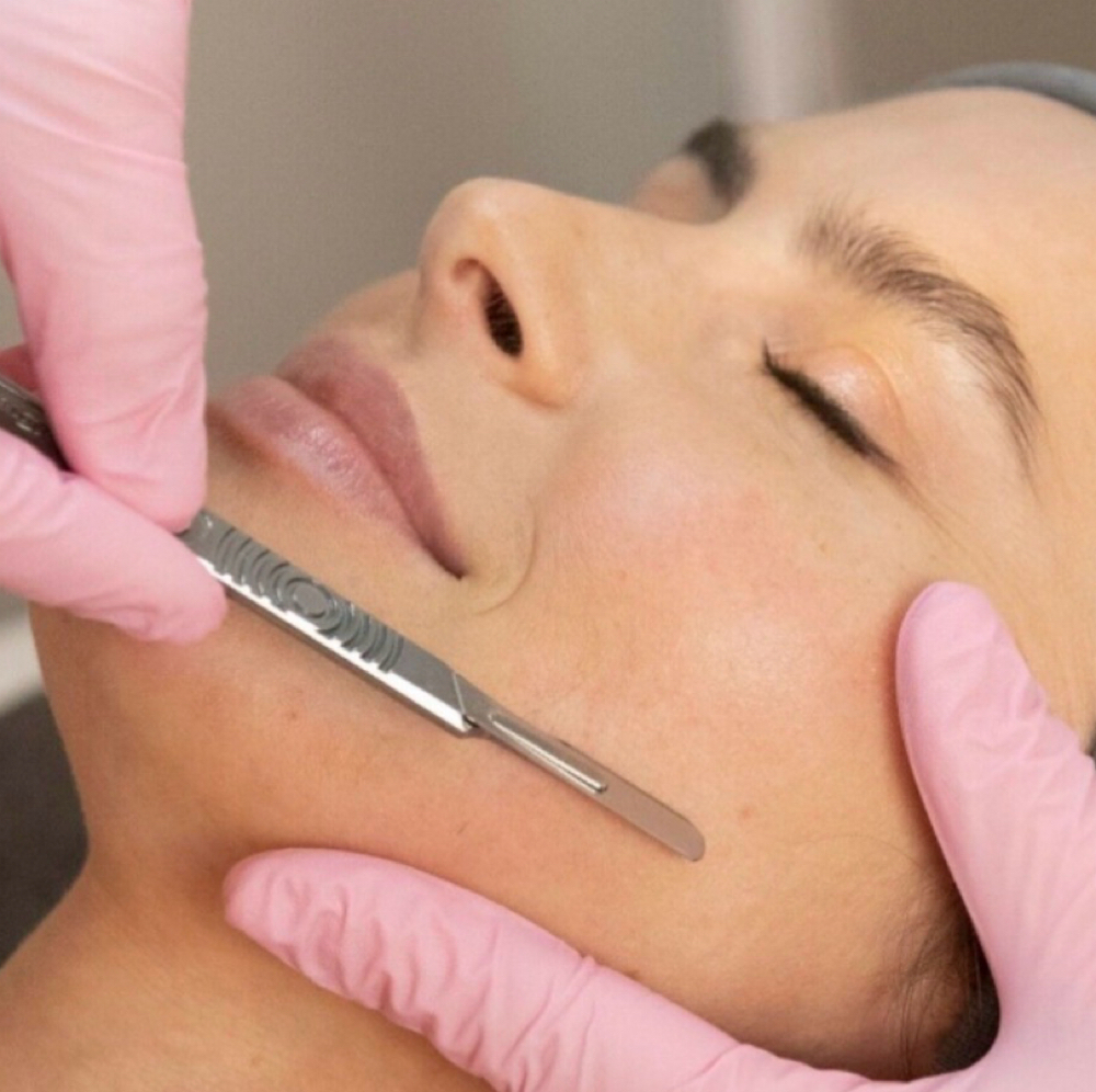 Dermaplane Add-On at Restored Glow Aesthetics in Whitehouse Station, NJ