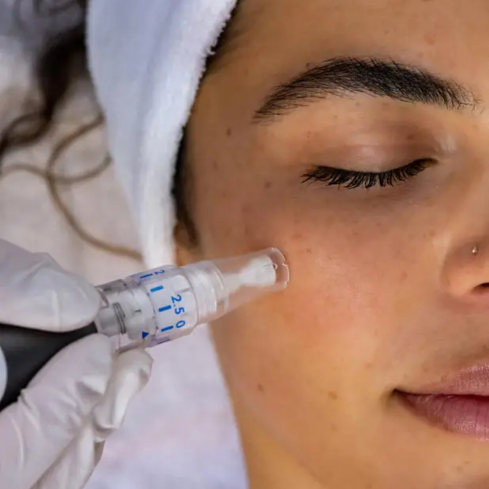Target Microneedling at B. Rucker Beauty Co. in Hendersonville, TN