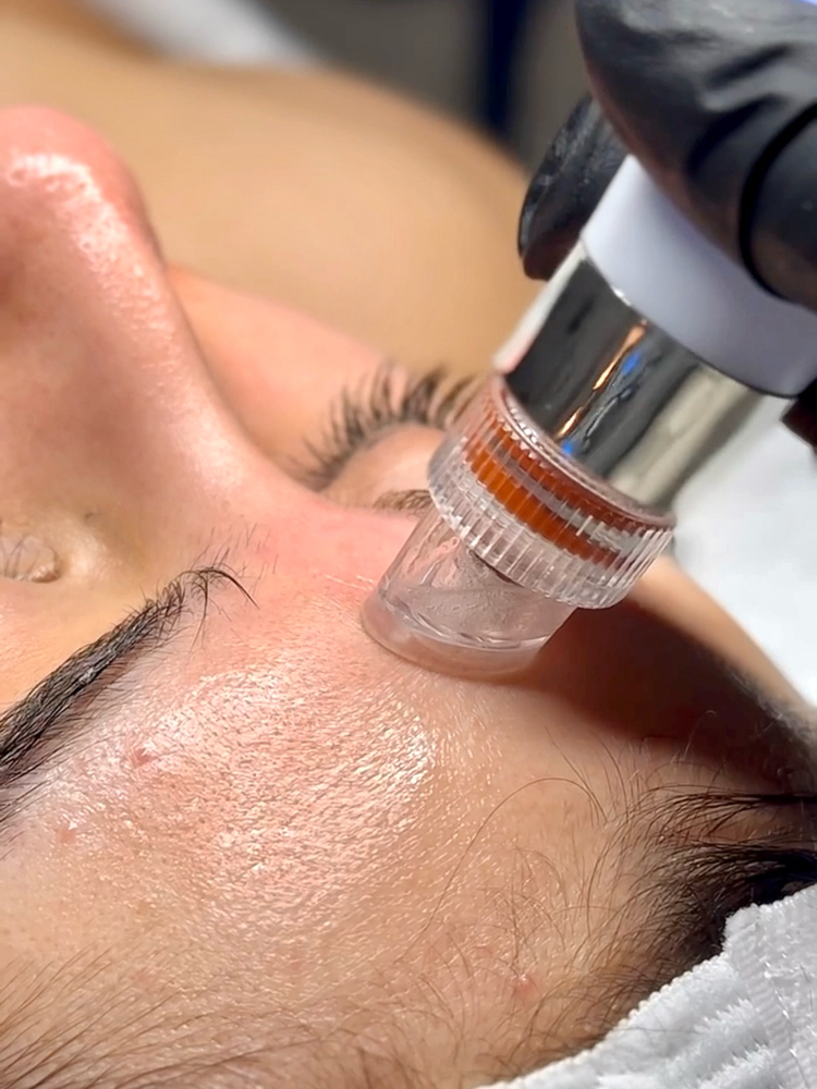 Hydrofacial and LED