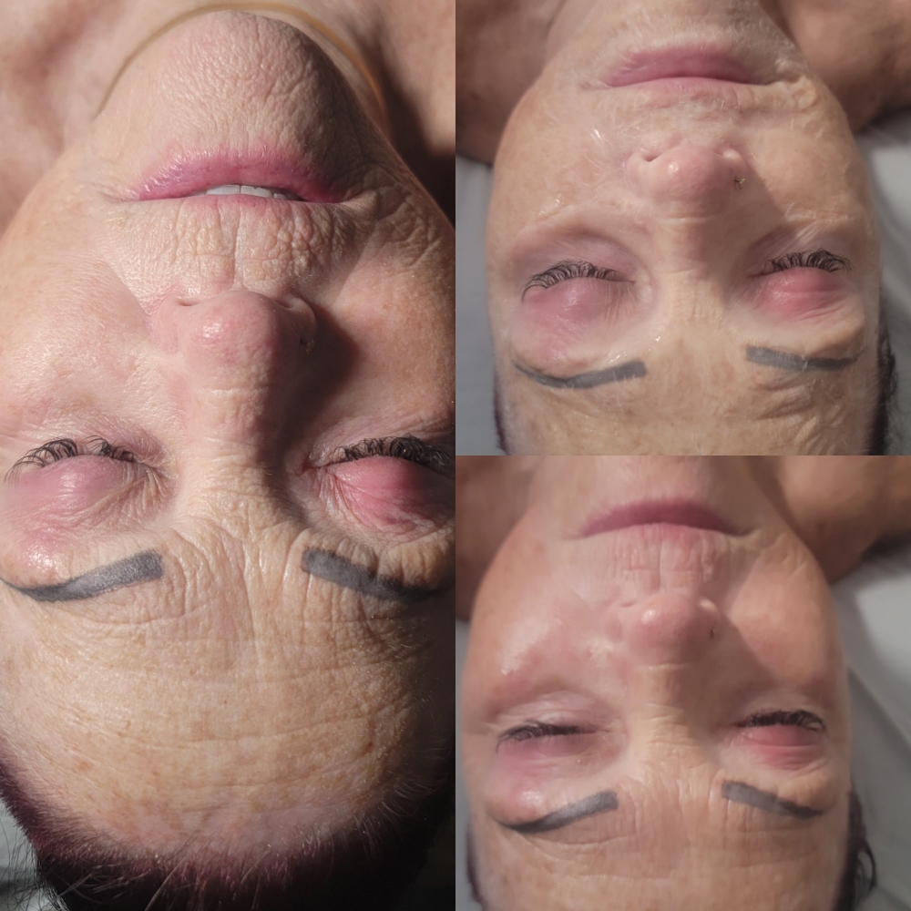 Custom Facial With Zombie Mask