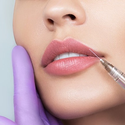 1ml HA Lip Augmentation at Aesthetic Artistry by Renee V in Roswell, NM