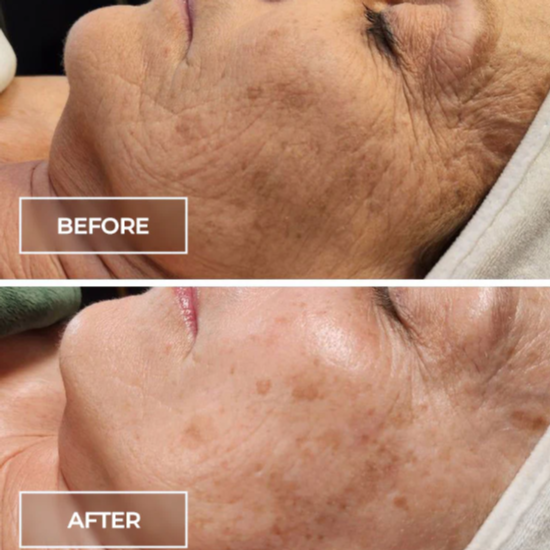 Cell Renewal Facial at Pure Canvas Co. in San Jose, CA