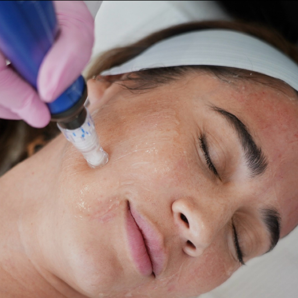 Hydrofacial at Prestige Aesthetics KC in Independence, MO