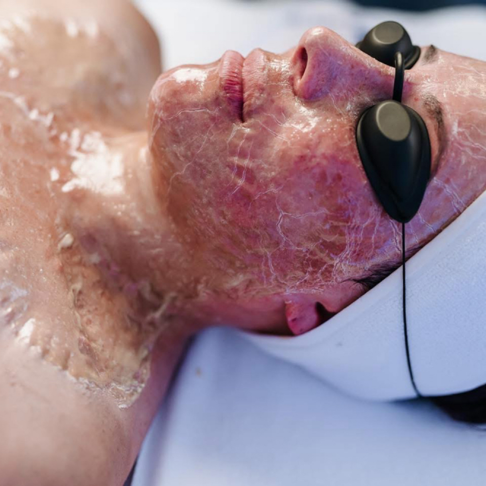 Firming Peptide Renewal Treatment at Ysabela Aesthetics in Buena Park, CA