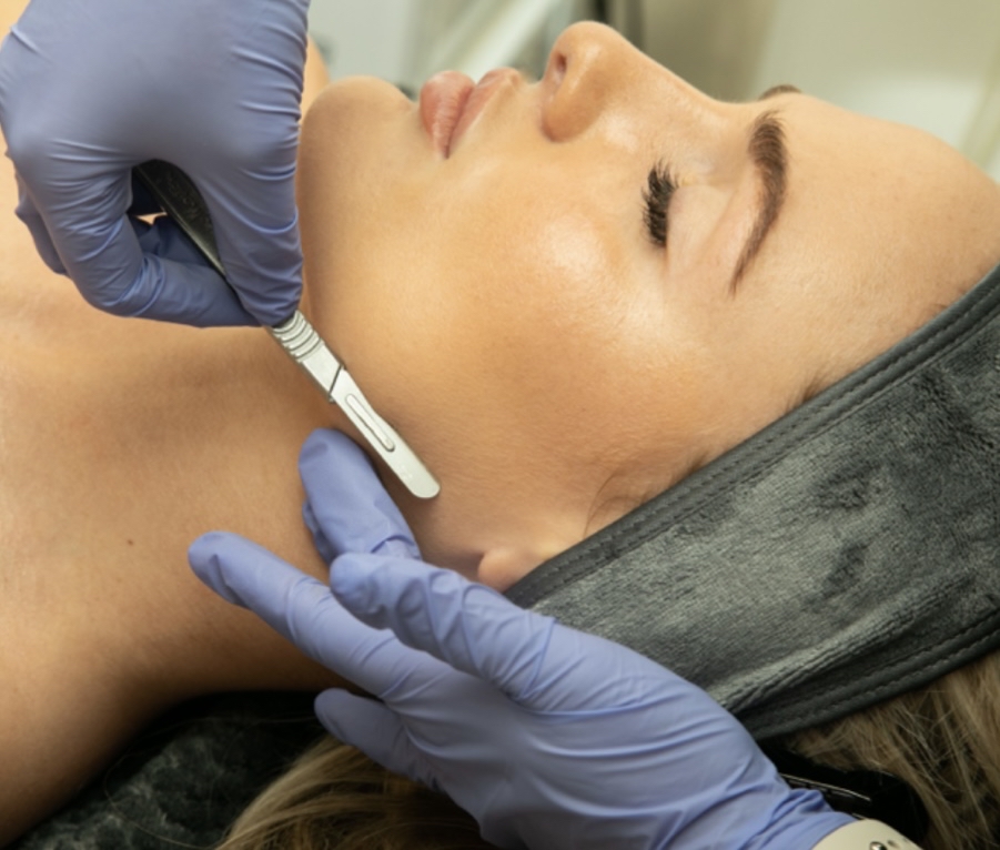 GLOW GETTER FACIAL WITH DERMAPLANE