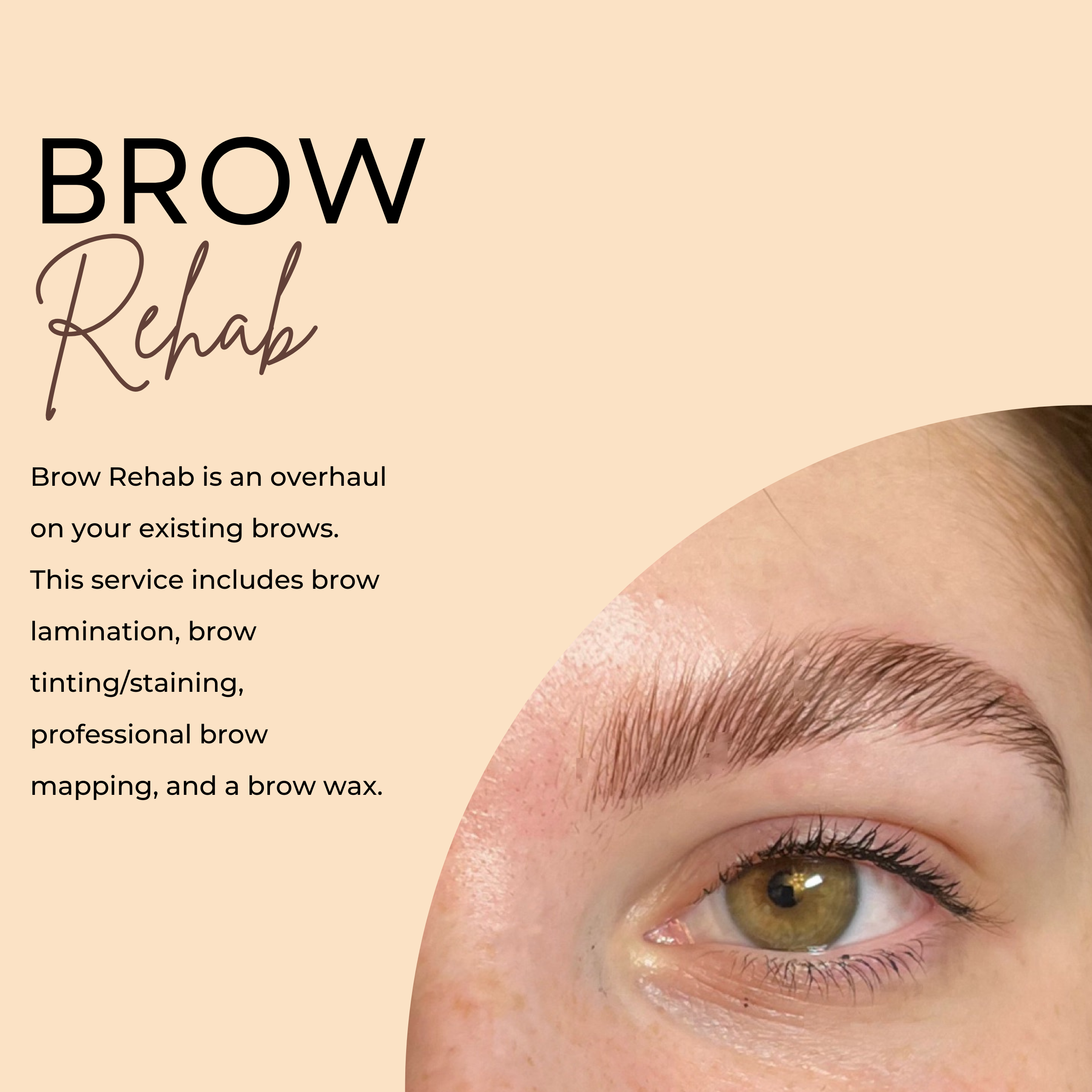 Brow Rehab