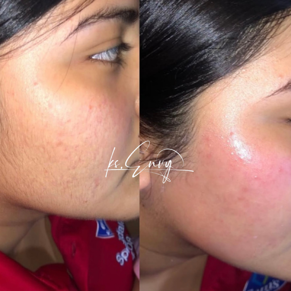 Face: Cheeks at KS.Envy in Columbus, OH