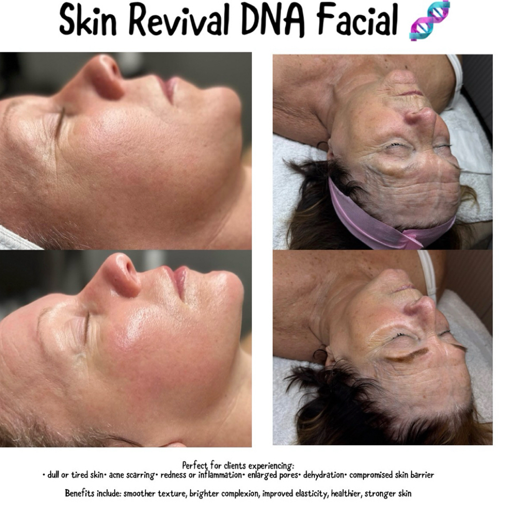 K Beauty Skin Revival DNA Facial. at Her Esthetics in Olean, NY