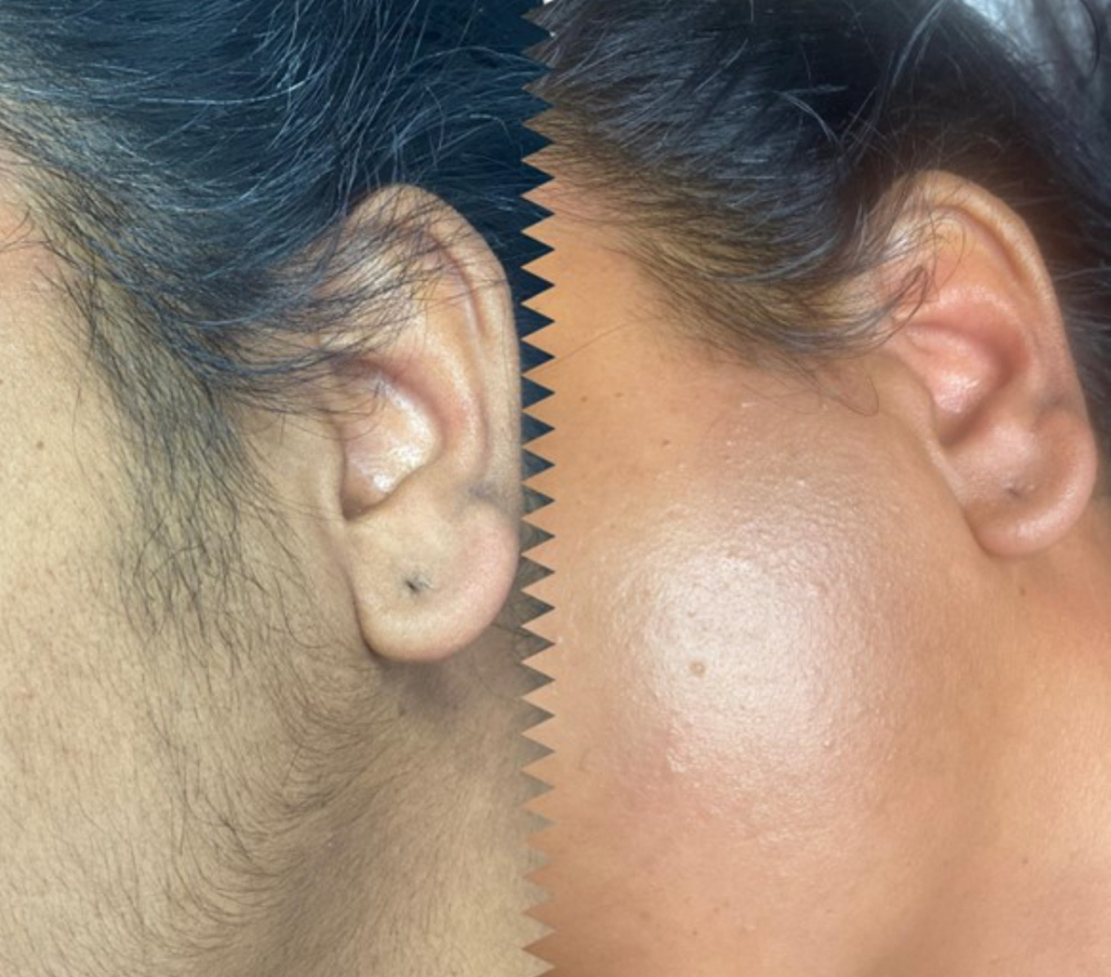 Full Face Wax✂️ at Bombshell Salon And Spa in Paducah, KY