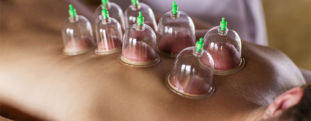 Add On Cupping