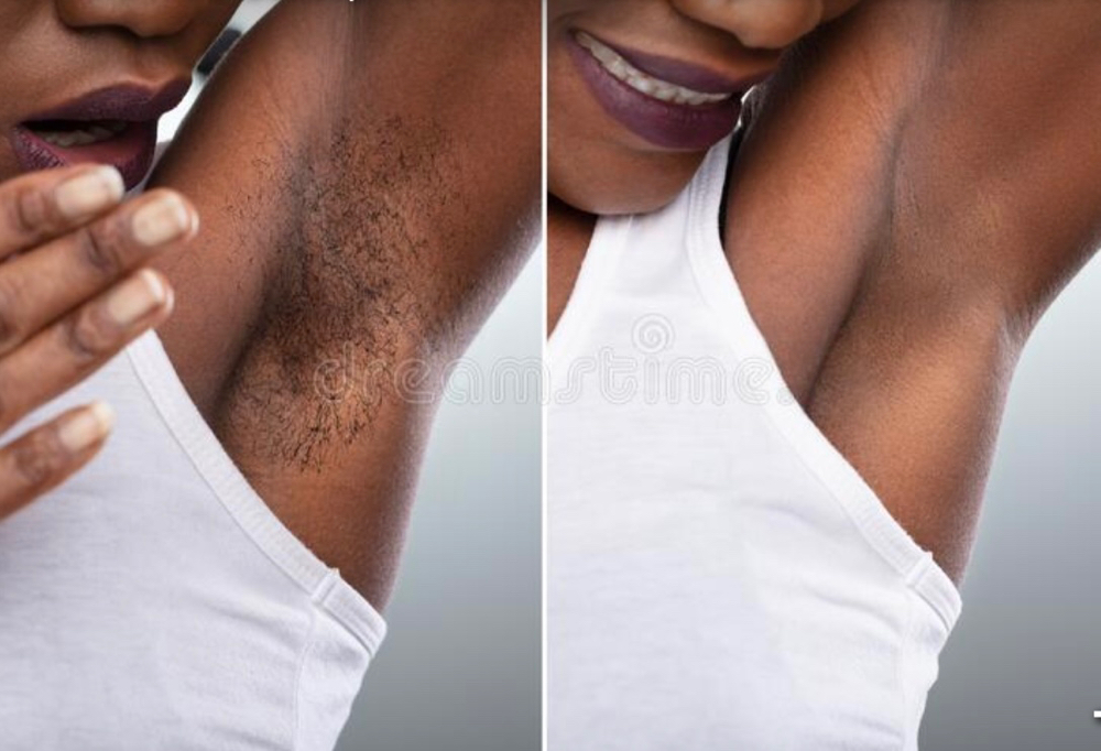Underarm Brightening Facial