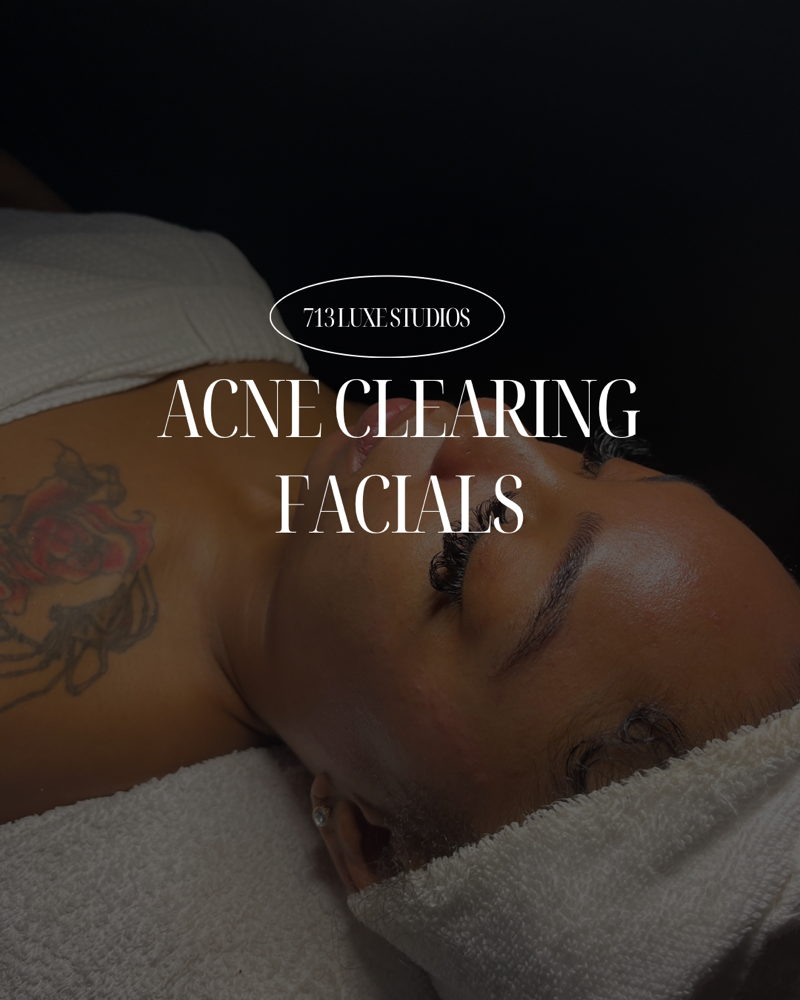 Acne Clearing Facial