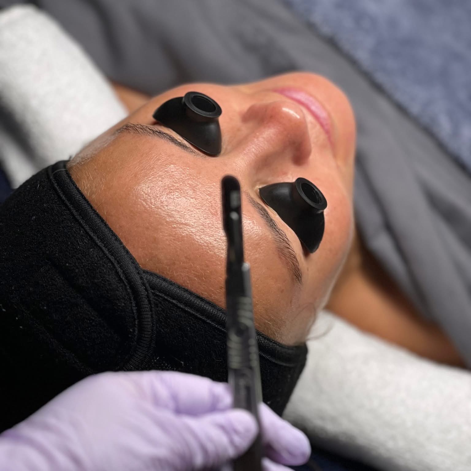 Dermaplane Facial at Blue Lotus Beauty Spa in Sheboygan, WI
