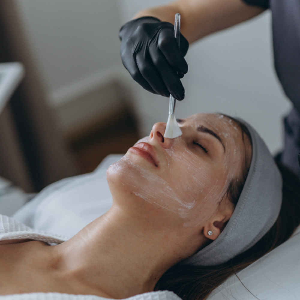 Chemical Peel (Microneedle) at Lunar Beauty Suites in Logan, UT