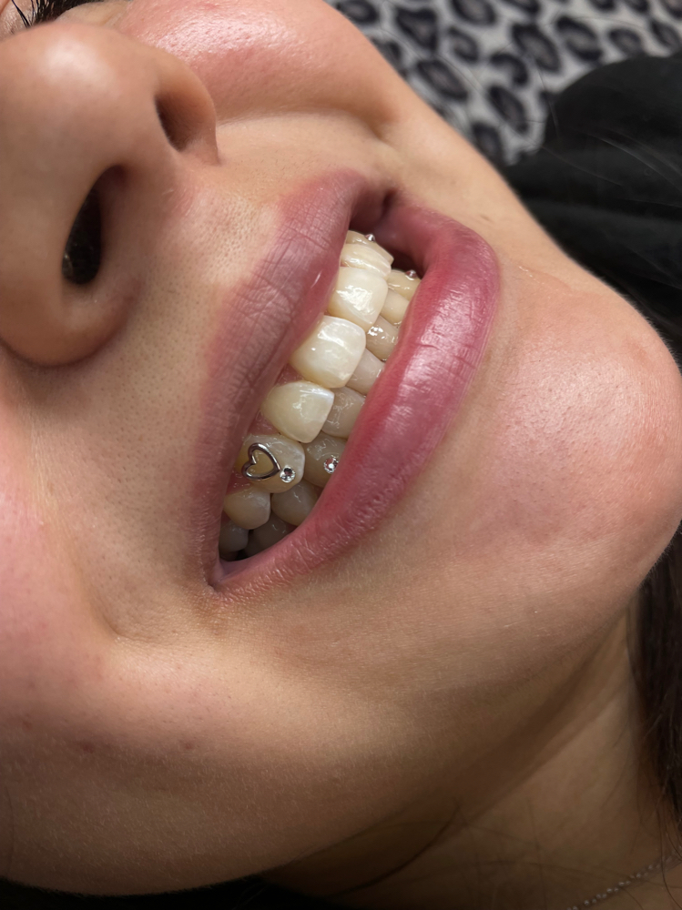 Tooth Gems 4 Gems
