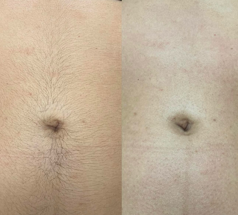 Stomach Wax