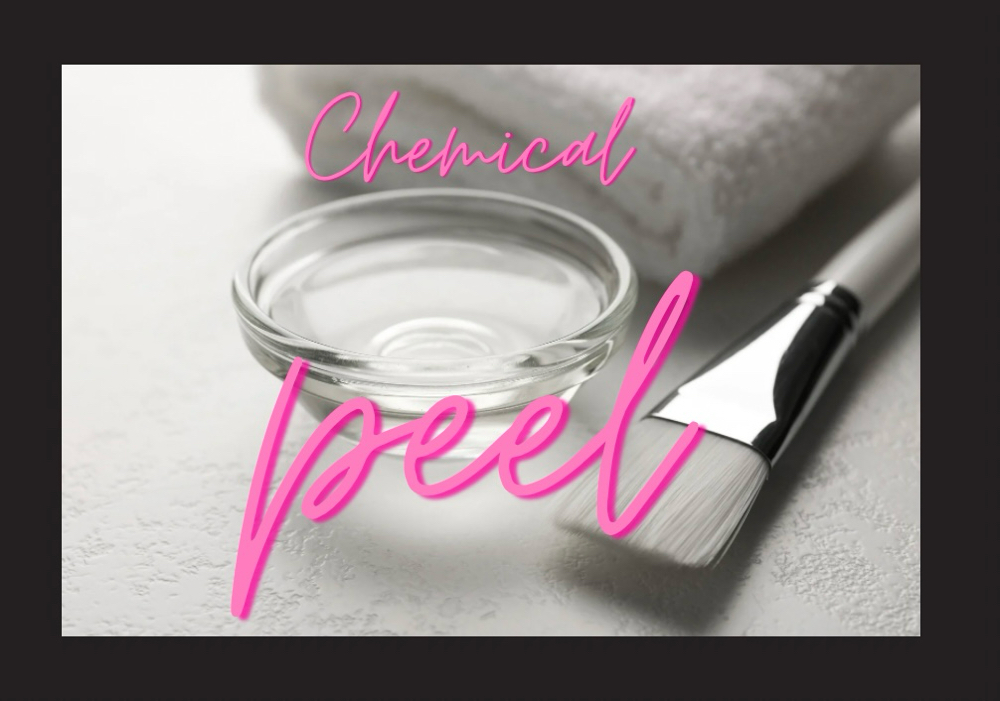 Chemical Peels