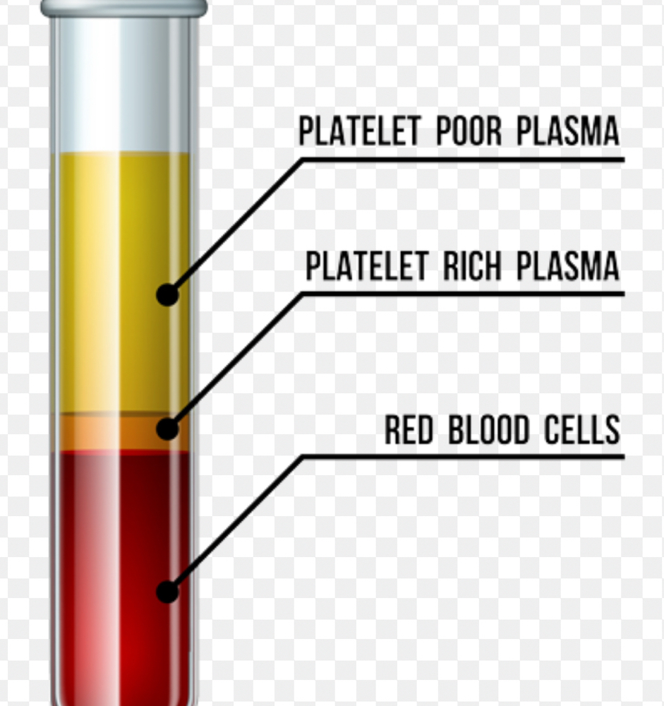 PRP