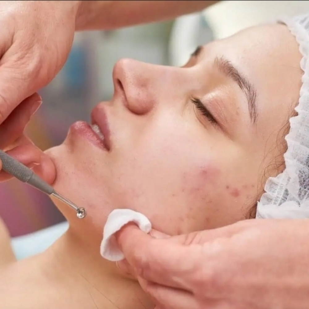 Teen Acne Solutions at Skin & Sage Skin Therapy in Las Vegas, NV
