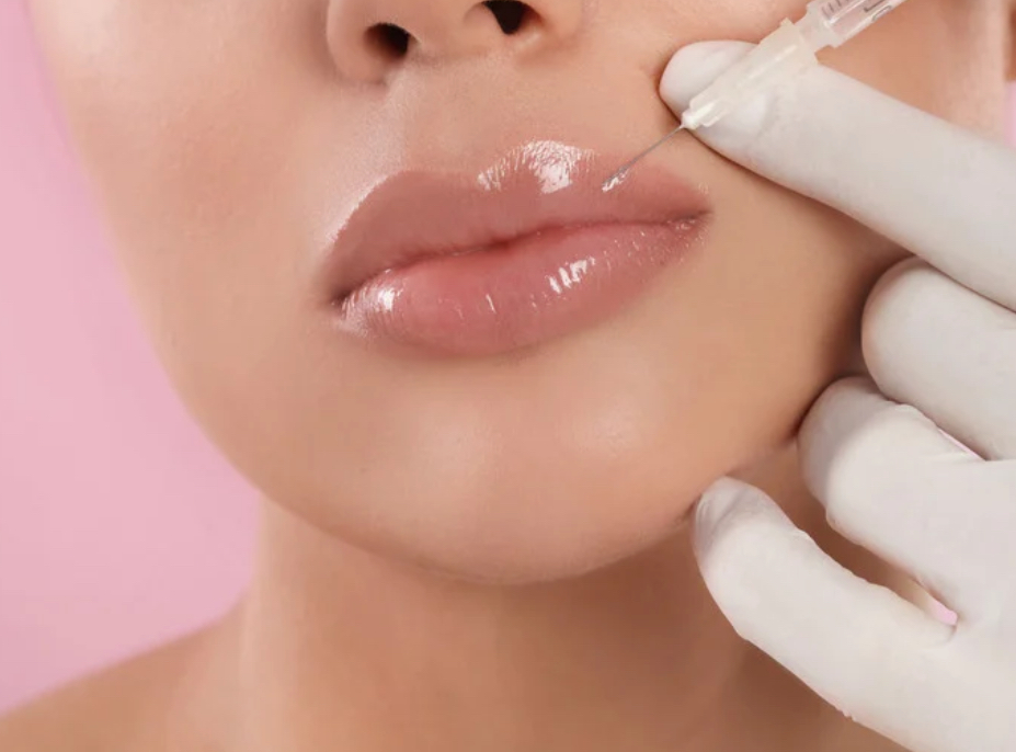 Full Lips at Optimist Aesthetics LLC in Kingsville, TX