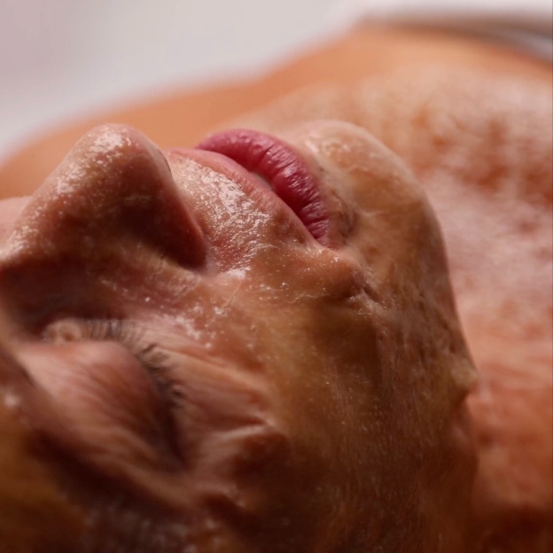 The Luxe Lift (No Tox Facial) at Nú Vanity Aesthetics in Pinellas Park, FL