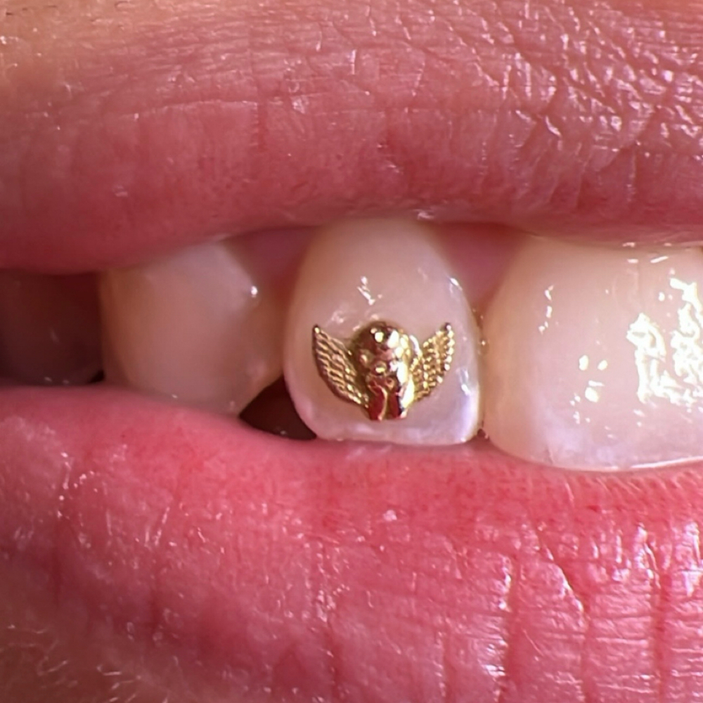 CHERUB > SCRUBᴺᴶ at MONMOUTH COUNTYᴺᴶ ✧ 1ST TOOTH JEWELER ↯ #POPURWAXINCHERRY in Hazlet, NJ