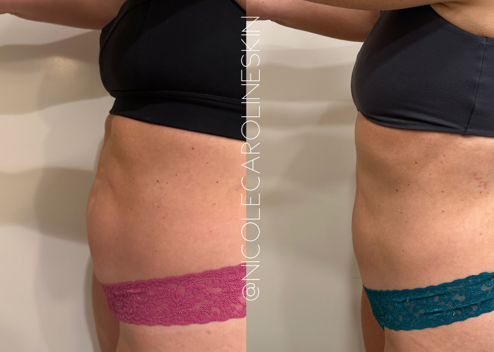 The BodyTight Series-