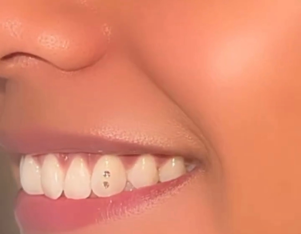 Tooth Gem