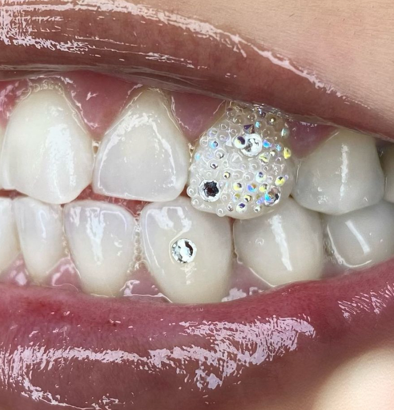 Fairy Dust