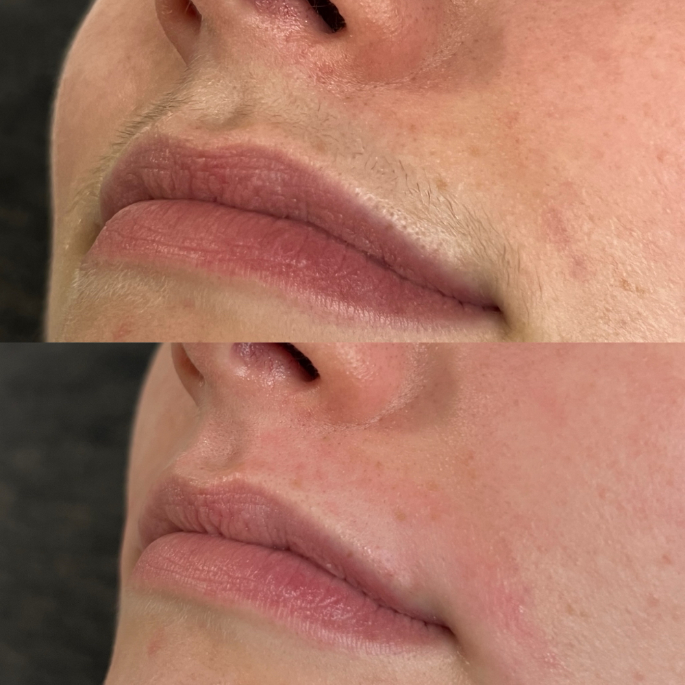 Upper Lip Wax