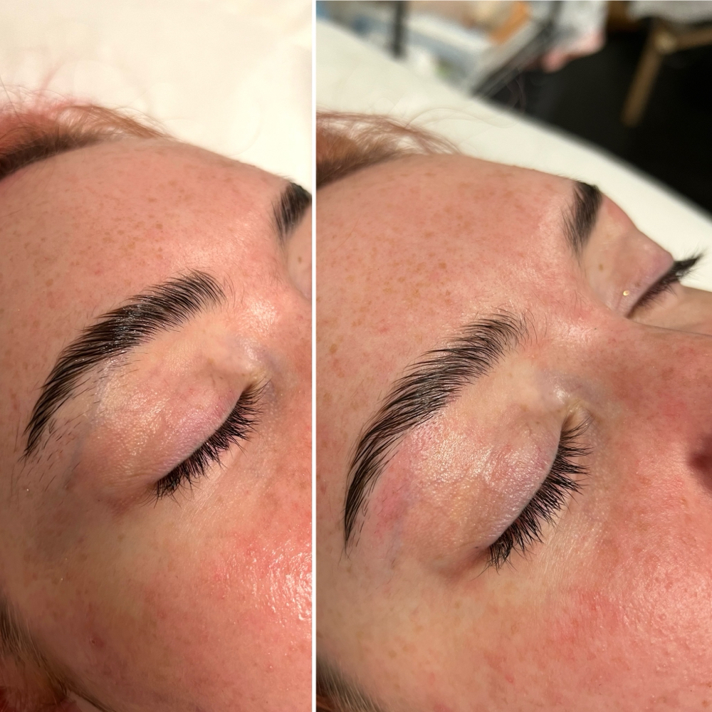 Brow Shaping
