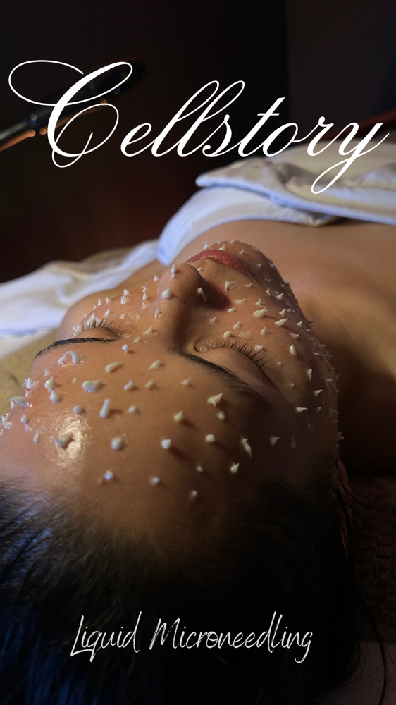 CELLSTORY Liquid Microneedling