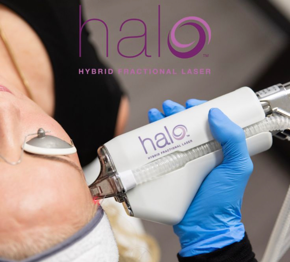 Sciton Resurfacing Laser