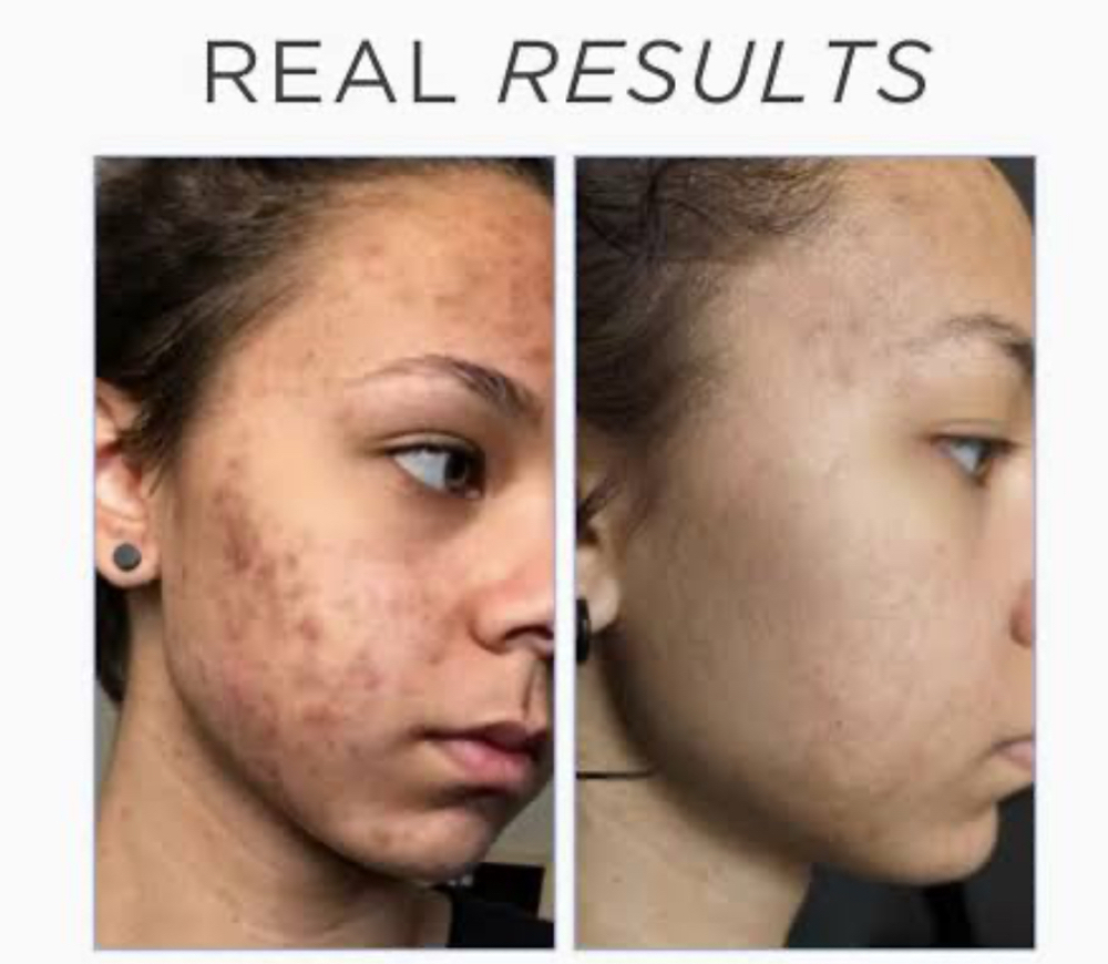 Deep Sea Peel