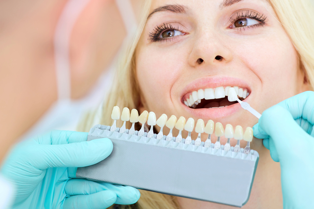 1 Hour Teeth Whitening