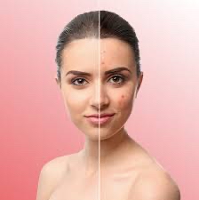 Clarity Facial