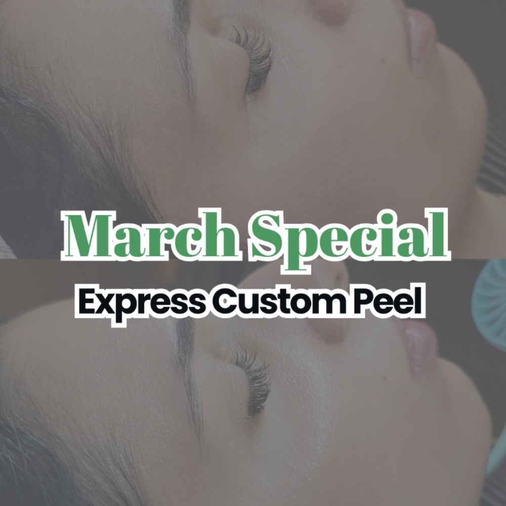 Custom Express Peel at Rival Aesthetics in spring, TX