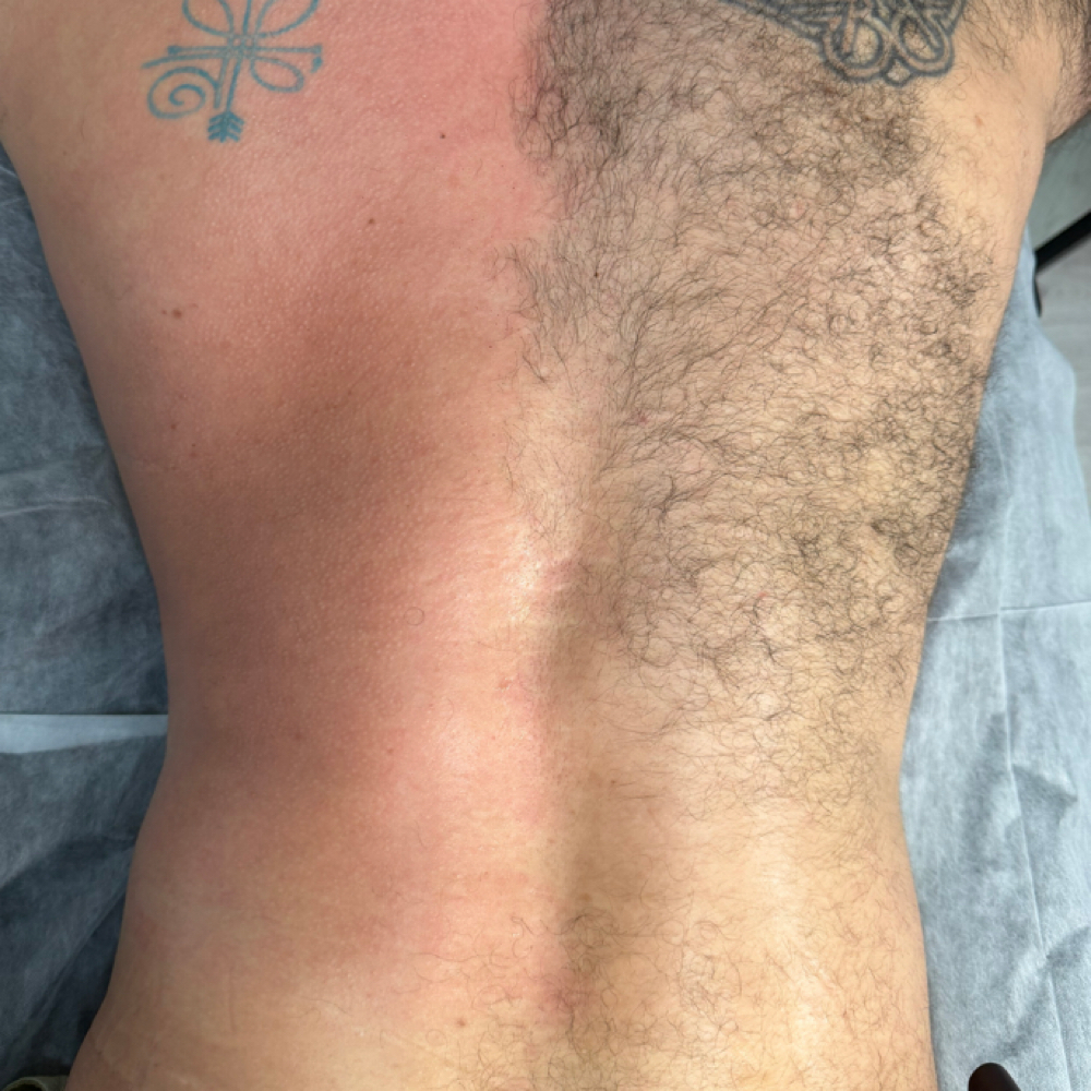 Back Wax + Mini Back Facial