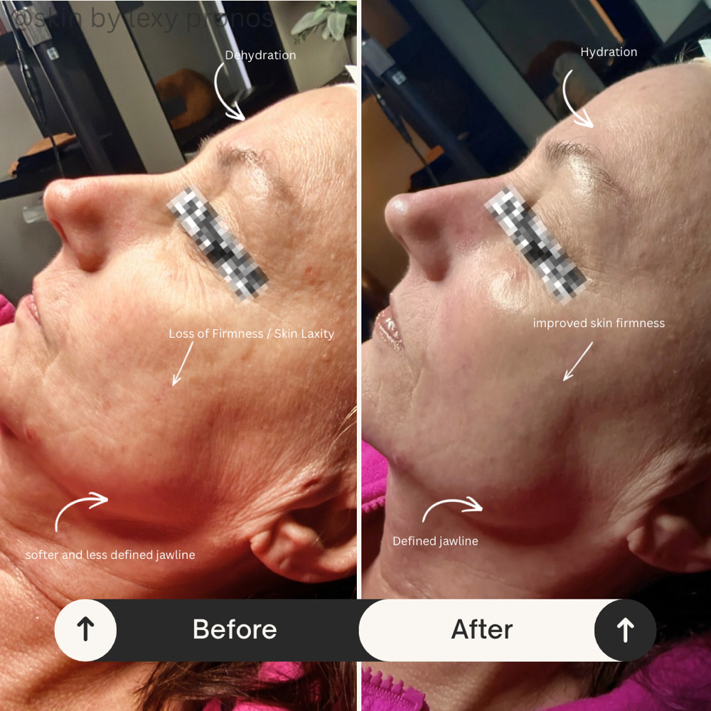 Age Defying Glow Facial at Gemini Esthetics in Naperville, IL